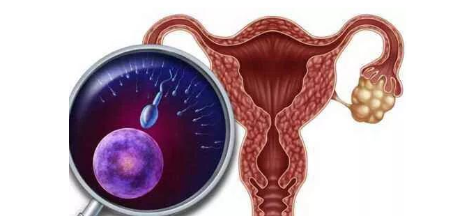 探索女性健康新篇章：揭秘宫腔粘连的成因与治疗
